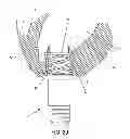 Fig. 29 - METHOD AND APPARATUS FOR SUTURELESSLY CONNECTING A CONDUIT TO A HOLLOW ORGAN