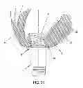 Fig. 31 - METHOD AND APPARATUS FOR SUTURELESSLY CONNECTING A CONDUIT TO A HOLLOW ORGAN