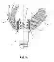 Fig. 33 - METHOD AND APPARATUS FOR SUTURELESSLY CONNECTING A CONDUIT TO A HOLLOW ORGAN