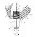 Fig. 37 - METHOD AND APPARATUS FOR SUTURELESSLY CONNECTING A CONDUIT TO A HOLLOW ORGAN