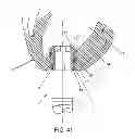 Fig. 41 - METHOD AND APPARATUS FOR SUTURELESSLY CONNECTING A CONDUIT TO A HOLLOW ORGAN