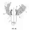Fig. 45 - METHOD AND APPARATUS FOR SUTURELESSLY CONNECTING A CONDUIT TO A HOLLOW ORGAN