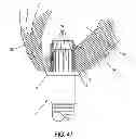 Fig. 46 - METHOD AND APPARATUS FOR SUTURELESSLY CONNECTING A CONDUIT TO A HOLLOW ORGAN
