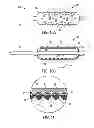 Fig. 08 - Apparatus and method for delivering intraluminal therapy