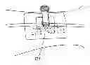 Fig. 01 - MEDICAL LINE SECUREMENT SYSTEM