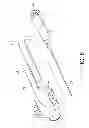 Fig. 07 - SAFE VEIN DETAINED NEEDLE