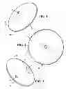 Fig. 02 - POST-NIPPLE RECONSTRUCTION PROTECTOR