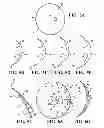 Fig. 05 - POST-NIPPLE RECONSTRUCTION PROTECTOR