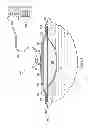 Fig. 02 - Dressing with asymmetric absorbent core for negative pressure wound therapy
