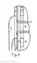 Fig. 03 - Ostomy Ring