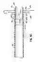 Fig. 10 - Two-piece transseptal cannula, delivery system, and method of delivery