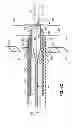 Fig. 14 - Two-piece transseptal cannula, delivery system, and method of delivery