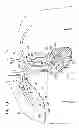 Fig. 30 - Two-piece transseptal cannula, delivery system, and method of delivery