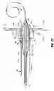Fig. 31 - Two-piece transseptal cannula, delivery system, and method of delivery