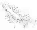 Fig. 01 - Suction catheter device and method