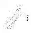 Fig. 02 - Suction catheter device and method