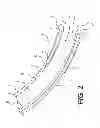 Fig. 03 - Suction catheter device and method
