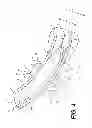 Fig. 05 - Suction catheter device and method
