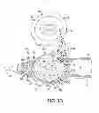 Fig. 05 - Adjustable stop for elongate medical device deflection mechanism