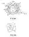 Fig. 07 - Adjustable stop for elongate medical device deflection mechanism