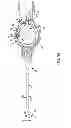 Fig. 10 - Adjustable stop for elongate medical device deflection mechanism