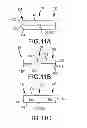 Fig. 13 - Adjustable stop for elongate medical device deflection mechanism