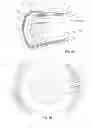 Fig. 09 - INNENKANT CATHETER TIP
