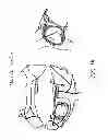 Fig. 03 - METHODS AND DEVICES FOR THE TREATMENT OF ATRIAL FIBRILLATION