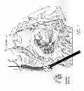 Fig. 07 - METHODS AND DEVICES FOR THE TREATMENT OF ATRIAL FIBRILLATION