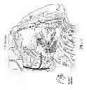 Fig. 10 - METHODS AND DEVICES FOR THE TREATMENT OF ATRIAL FIBRILLATION