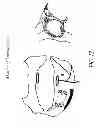Fig. 14 - METHODS AND DEVICES FOR THE TREATMENT OF ATRIAL FIBRILLATION