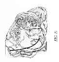 Fig. 15 - METHODS AND DEVICES FOR THE TREATMENT OF ATRIAL FIBRILLATION