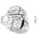 Fig. 17 - METHODS AND DEVICES FOR THE TREATMENT OF ATRIAL FIBRILLATION