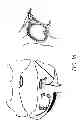 Fig. 18 - METHODS AND DEVICES FOR THE TREATMENT OF ATRIAL FIBRILLATION