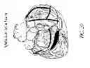 Fig. 22 - METHODS AND DEVICES FOR THE TREATMENT OF ATRIAL FIBRILLATION