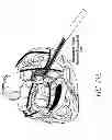 Fig. 27 - METHODS AND DEVICES FOR THE TREATMENT OF ATRIAL FIBRILLATION