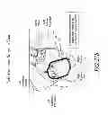 Fig. 28 - METHODS AND DEVICES FOR THE TREATMENT OF ATRIAL FIBRILLATION