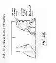 Fig. 33 - METHODS AND DEVICES FOR THE TREATMENT OF ATRIAL FIBRILLATION