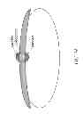 Fig. 40 - METHODS AND DEVICES FOR THE TREATMENT OF ATRIAL FIBRILLATION