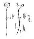 Fig. 41 - METHODS AND DEVICES FOR THE TREATMENT OF ATRIAL FIBRILLATION