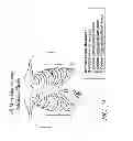 Fig. 45 - METHODS AND DEVICES FOR THE TREATMENT OF ATRIAL FIBRILLATION