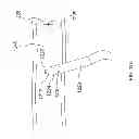 Fig. 28 - Method and apparatus for tissue ablation