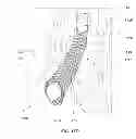 Fig. 40 - Method and apparatus for tissue ablation