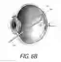 Fig. 10 - MEDICAL SYSTEM AND METHOD OF USE