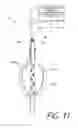 Fig. 17 - MEDICAL SYSTEM AND METHOD OF USE