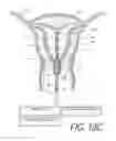 Fig. 20 - MEDICAL SYSTEM AND METHOD OF USE