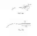 Fig. 06 - Systems and methods for neuromodulation for treatment of pain and other disorders associated with nerve conduction