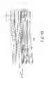 Fig. 09 - Systems and methods for neuromodulation for treatment of pain and other disorders associated with nerve conduction