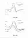 Fig. 31 - Methods and systems for optimizing lesion placement to minimize and treat cardiac fibrillation