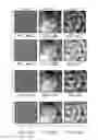 Fig. 41 - Methods and systems for optimizing lesion placement to minimize and treat cardiac fibrillation
